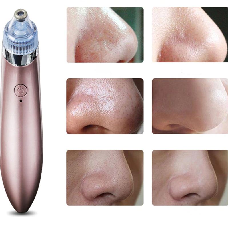 SUCTION PRO Extractor de puntos negros y espinillas