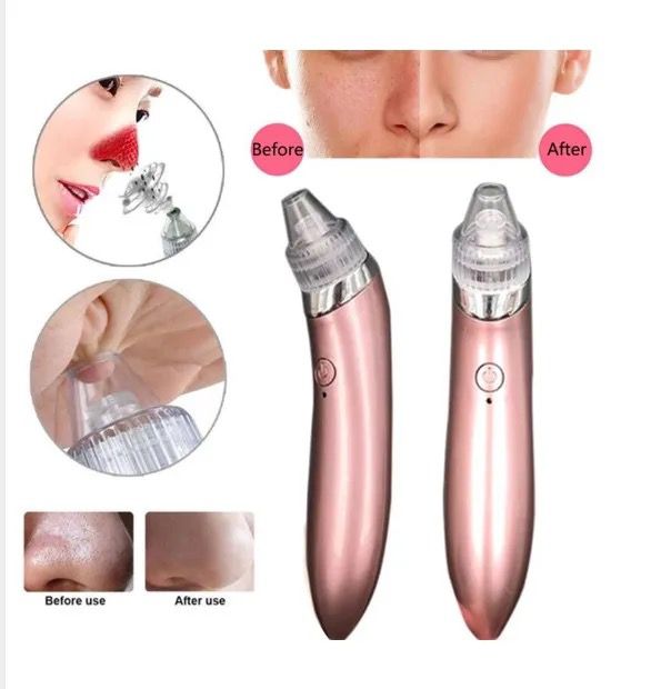 SUCTION PRO Extractor de puntos negros y espinillas